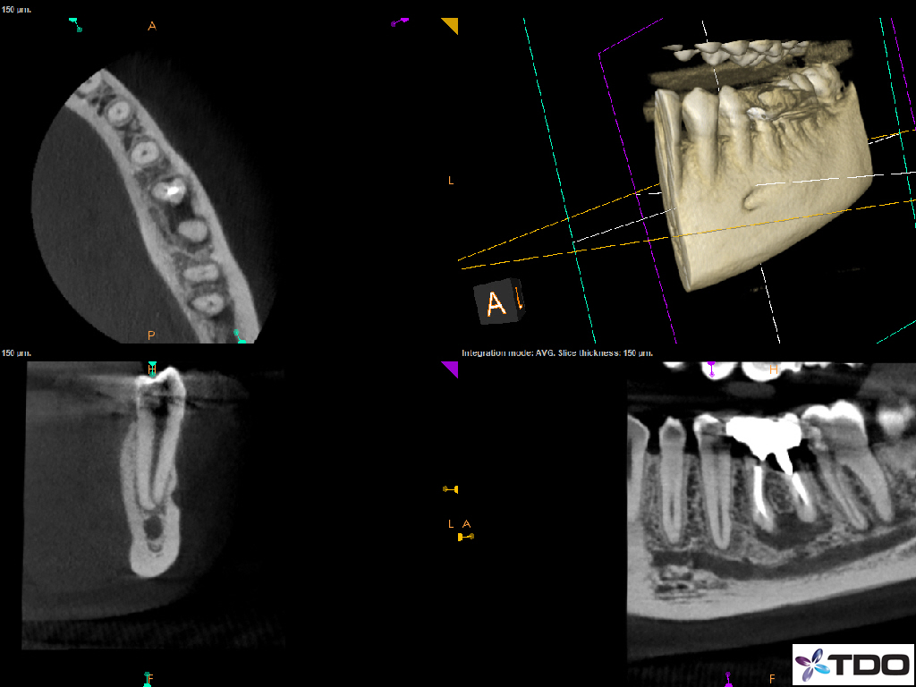 cbct1