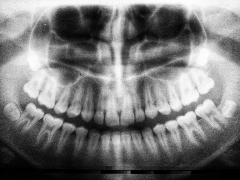 Digital imaging in endodontics