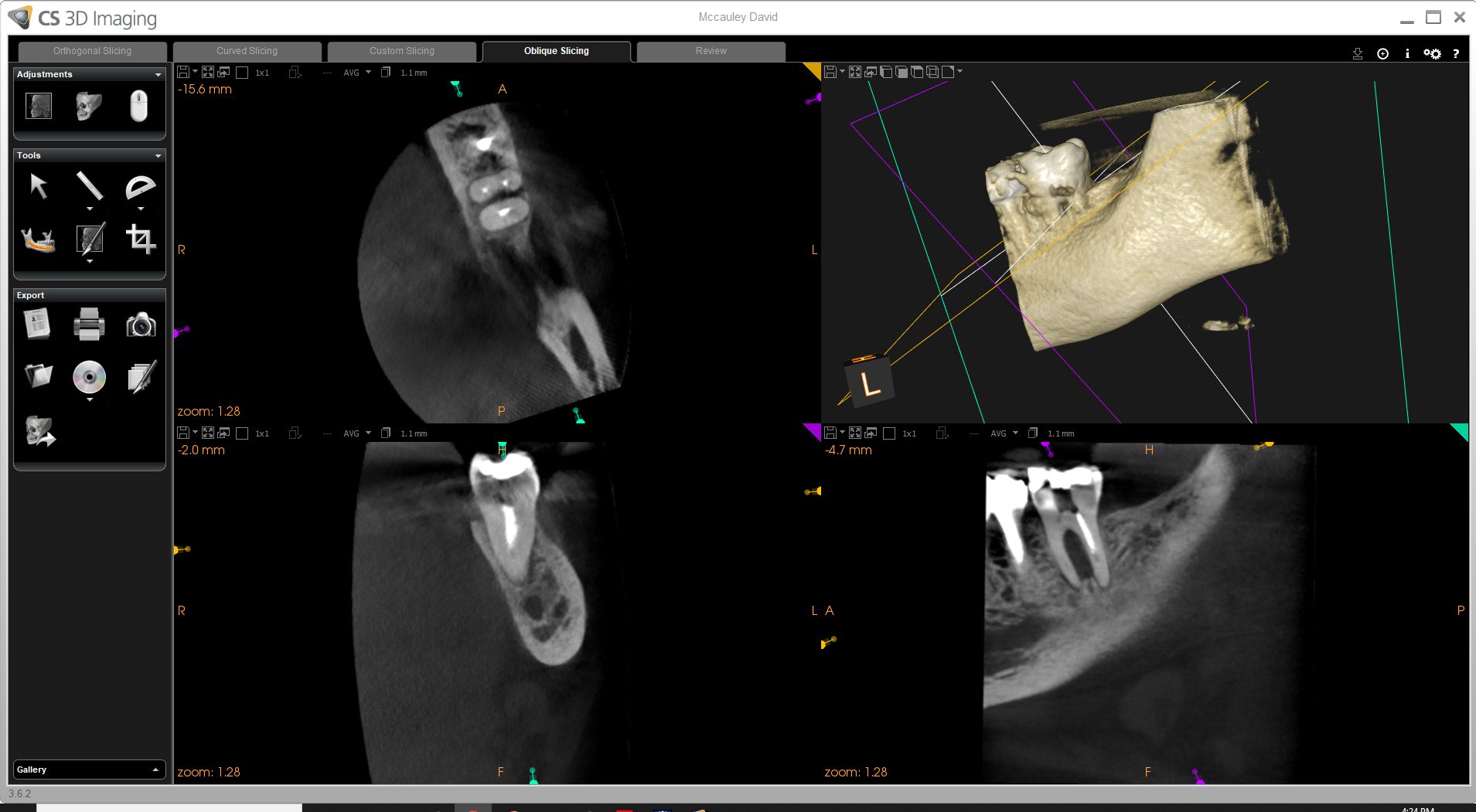 Parkside endodontics Conebeam technology