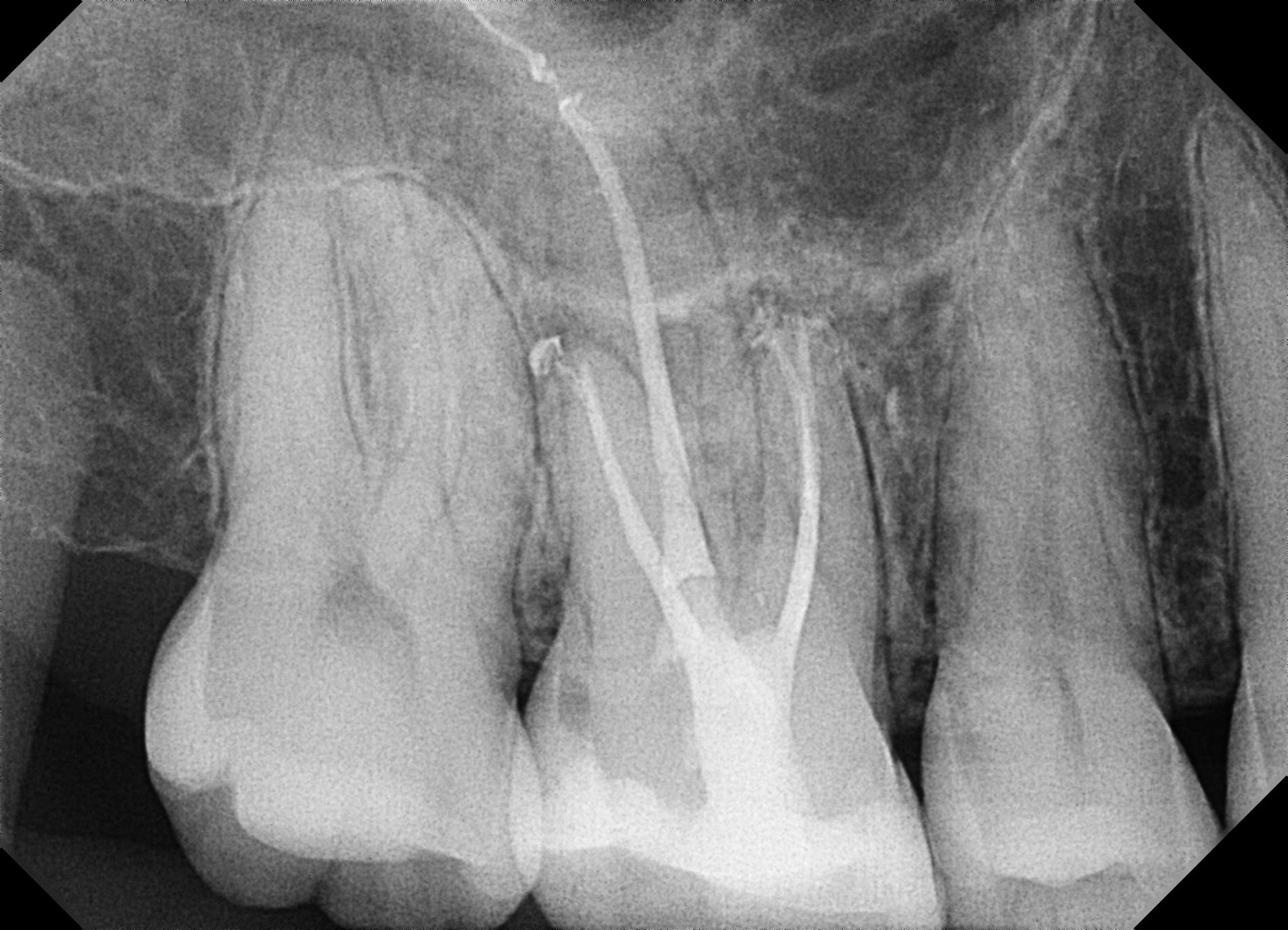 Parkside Endodontics digital xrays