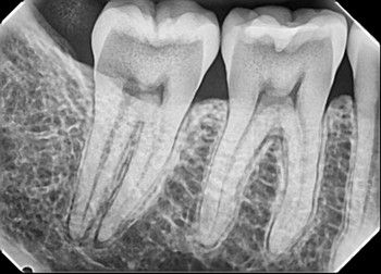 Digital Radiography