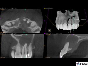 central-texas-endodontics-conebeam-cbct-300x225