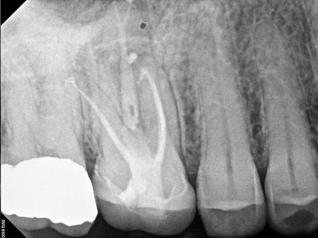 central texas - radiograph