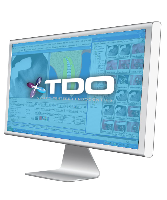 tdo-endodontics-software2 tdo-endodontics-software2