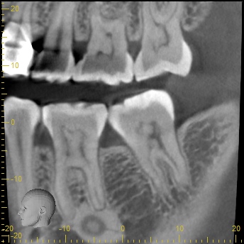 CBCT photo