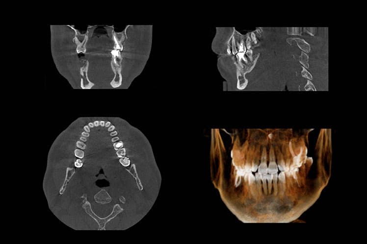 LVE CBCT 1