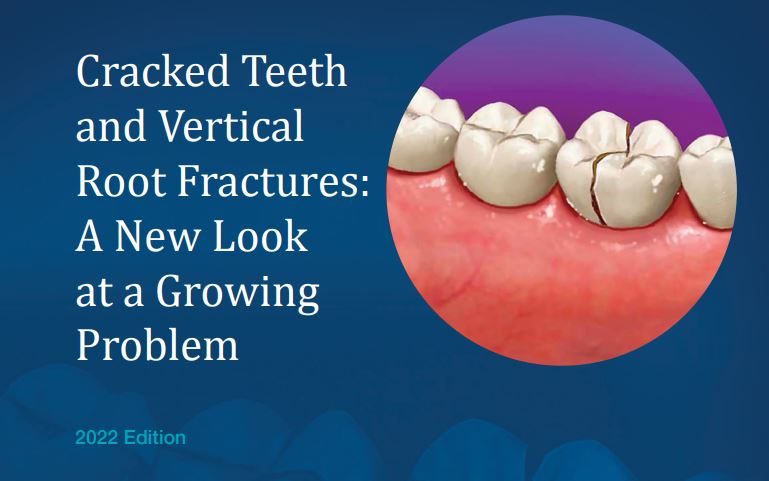 Endodontic Topics of Interest - Saddleback Valley Endodontics