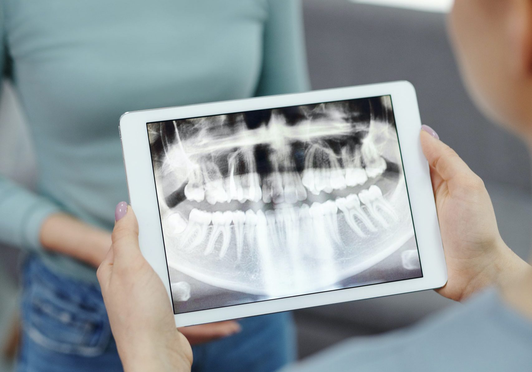 Endodontic root canal treatment process. Medically accurate tooth 3D  illustration. - LVI Global