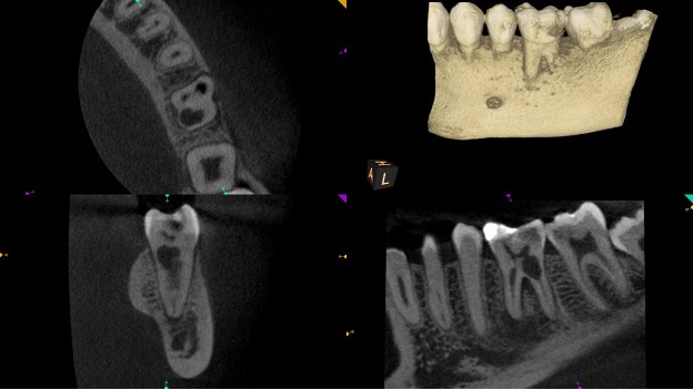 CBCT (2)