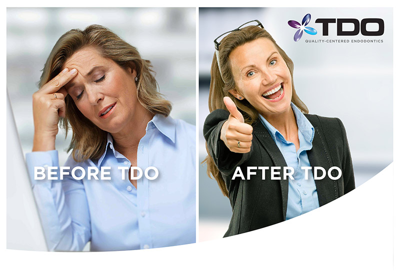 before-after-tdo
