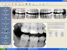 Valley Endodontics Digital Radiography